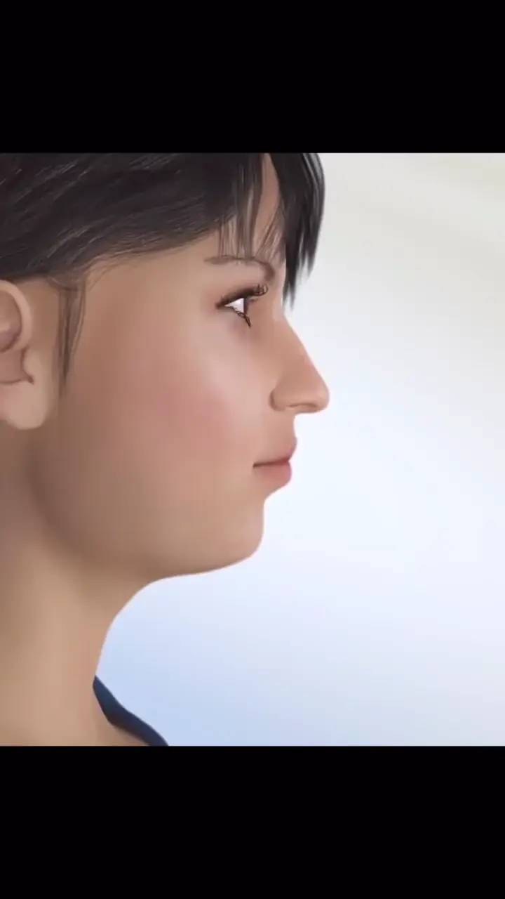 Planejamento virtual 3D do perfil facial em cirurgia ortognática